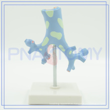 PNT-0751 Trachea Bronchi model for medical use